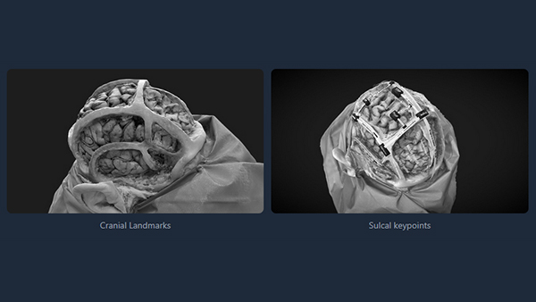 Craniometric and Sulcal keypoints
