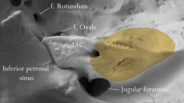 Copenhagen Skull Base Dissection Manual - 3D Atlas of Neurological Surgery