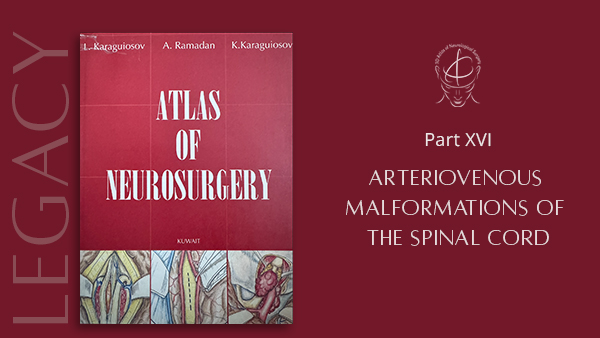 16. Arteriovenous Malformations of the Spinal Cord