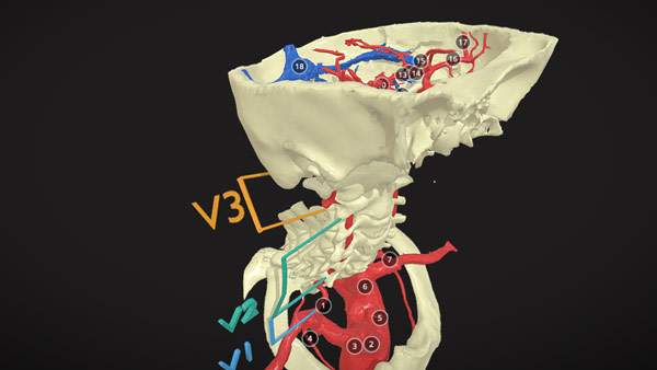 Neck And Intracranial Vessel Anatomy - 3D Atlas Of Neurological Surgery