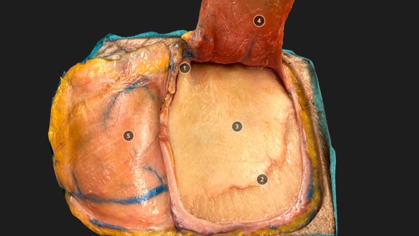Advanced Cranial Approaches - 3D Atlas of Neurological Surgery